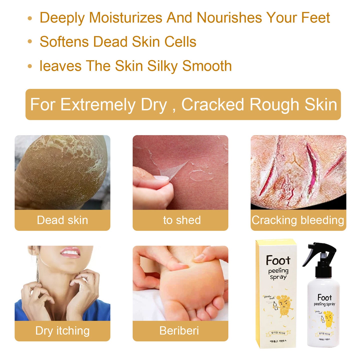Brighten Spray To Remove Dead Skin And Calluses And Whiten Feet