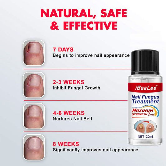 Thickening Of Special Bacteriostatic Liquid For Onychomycosis