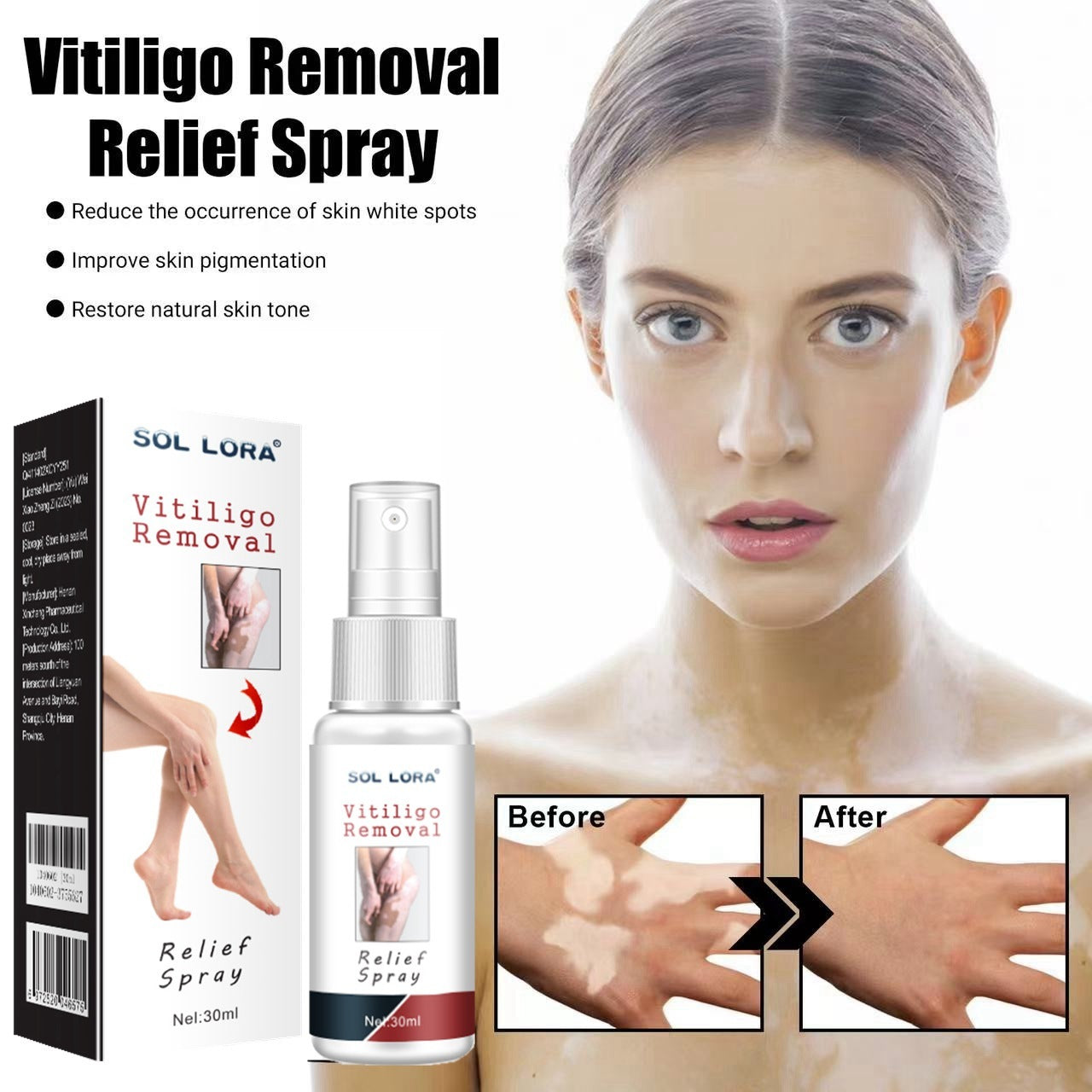 Moisturizing And Lightening White Spots, Flower Spots, Sweat Spots, Skin Care Spray