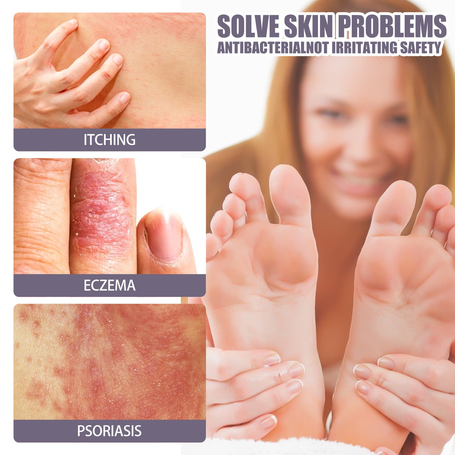 Hand And Foot Care Spray Relieves Dry Skin